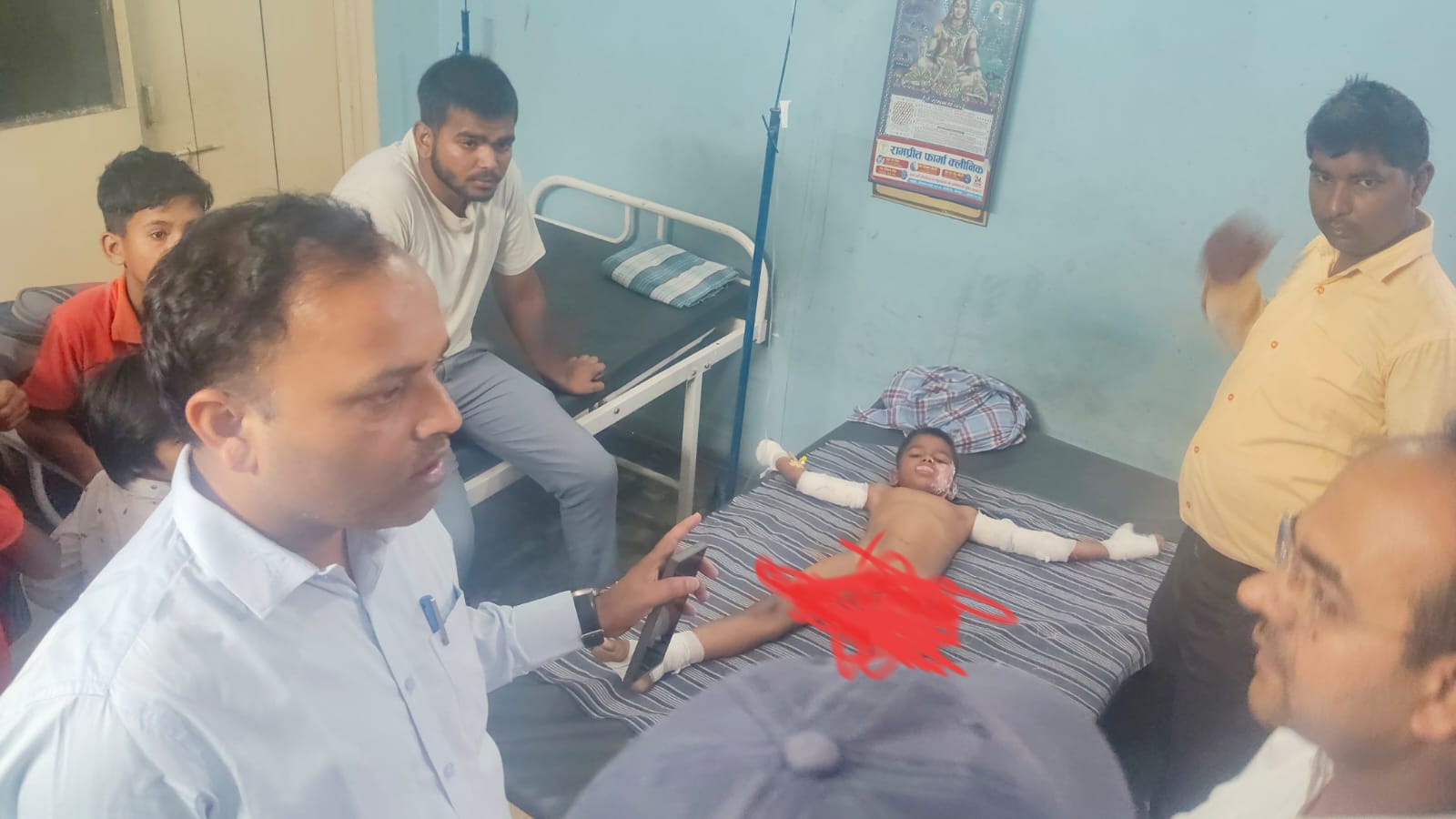 रामुडीह में गेहूं के डंठलों में लगी आग से पांच बच्चे झुलसे, एक की हालत गंभीर