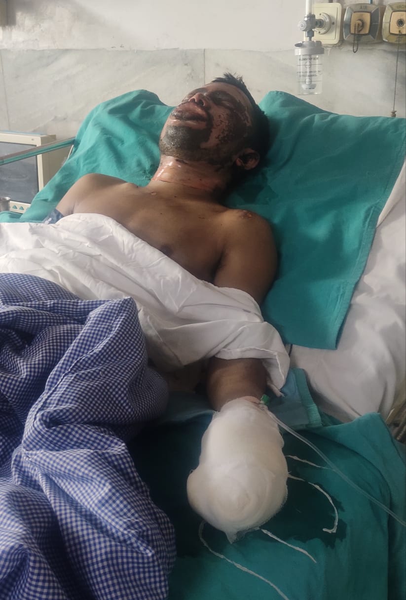 बारा में इंडस्ट्रियल टेरर! बारा के PP GCL प्लांट में 11 केबी ब्रेकर ब्लास्ट—तीन घायल, एक की हालत नाज़ुक; फ्रेसरों से जबरन करवाया गया था जोखिमभरा काम