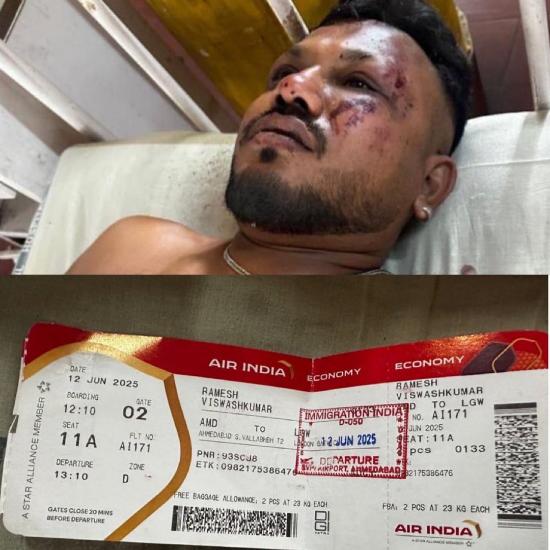 अहमदाबाद हादसे में 241 की मौत, लेकिन "एक चमत्कार" बना रमेश जी का ज़िंदा बचना!